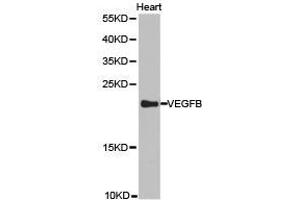 Western Blotting (WB) image for anti-Vascular Endothelial Growth Factor B (VEGFB) antibody (ABIN1875323) (VEGFB 抗体)
