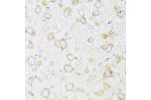 Immunohistochemistry of paraffin-embedded rat brain using BRSK1 antibody  at dilution of 1:100 (40x lens). (BRSK1 抗体  (AA 310-510))