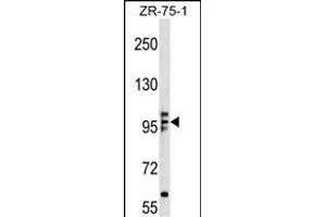 KIF20A Antibody (N-term) (ABIN1539162 and ABIN2848683) western blot analysis in ZR-75-1 cell line lysates (35 μg/lane). (KIF20A 抗体  (N-Term))