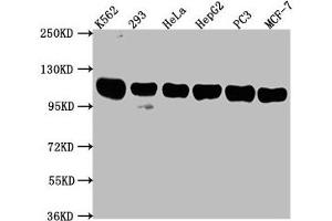 Western Blot Positive WB detected in: K562 whole cell lysate, 293 whole cell lysate, Hela whole cell lysate, HepG2 whole cell lysate, PC3 whole cell lysate, MCF-7 whole cell lysate All lanes: ITCH antibody at 1:2000 Secondary Goat polyclonal to rabbit IgG at 1/50000 dilution Predicted band size: 103, 99, 87 kDa Observed band size: 103 kDa