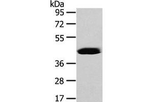 Gel: 8 % SDS-PAGE, Lysate: 40 μg, Lane: Hela cell, Primary antibody: ABIN7128077(VASH2 Antibody) at dilution 1/450 dilution, Secondary antibody: Goat anti rabbit IgG at 1/8000 dilution, Exposure time: 40 seconds (Vasohibin 2 抗体)