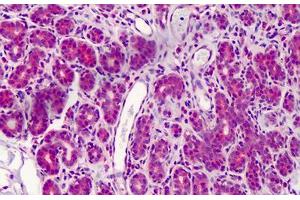 Human Breast: Formalin-Fixed, Paraffin-Embedded (FFPE) (FANCC 抗体  (C-Term))