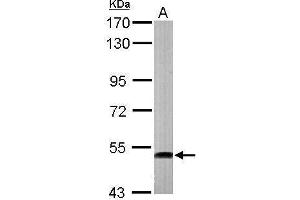 ATP6V1H anticorps  (Center)