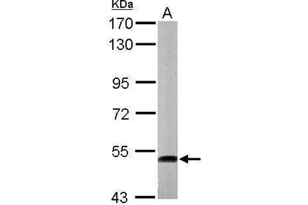ATP6V1H anticorps  (Center)