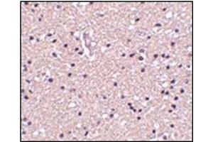 Immunohistochemistry of op18 in human brain tissue with this product at 2. (Stathmin 1 抗体  (N-Term))