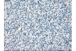 Immunohistochemical staining of paraffin-embedded colon tissue using anti-LTA4H mouse monoclonal antibody. (LTA4H 抗体)