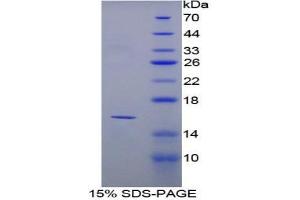 SDS-PAGE analysis of Mouse PPARG Protein. (PPARG 蛋白)