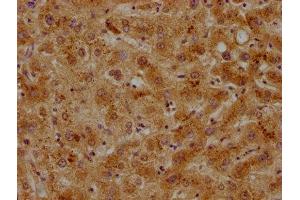 IHC image of ABIN7139731 diluted at 1:500 and staining in paraffin-embedded human liver tissue performed on a Leica BondTM system.