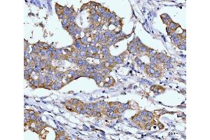 IHC analysis of DHODH using anti-DHODH antibody (ABIN7603139). (DHODH 抗体  (N-Term))
