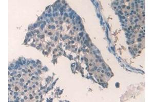 Immunohistochemistry (IHC) image for anti-Profilin 2 (PFN2) (AA 5-140) antibody (ABIN7437743)