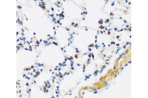Immunohistochemistry of paraffin-embedded Mouse lung using APOBEC3F Polyclonal Antibody at dilution of 1:100 (40x lens). (APOBEC3F 抗体)