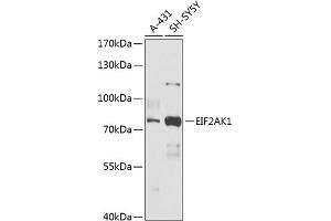 Western blot analysis of extracts of various cell lines, using EIF2 antibody (ABIN6131600, ABIN6140021, ABIN6140022 and ABIN6218371) at 1:1000 dilution. (EIF2AK1 抗体  (AA 371-630))