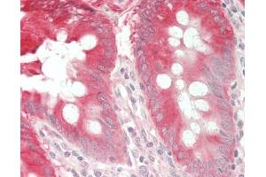 Human Colon: Formalin-Fixed, Paraffin-Embedded (FFPE). (Calpastatin 抗体  (FITC))