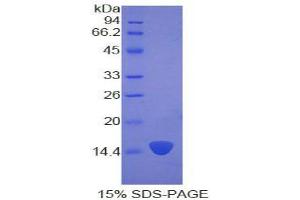 SDS-PAGE analysis of Human Keratin 2 Protein. (Keratin 2 Protein (KRT2))