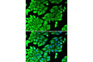 Immunofluorescence analysis of U2OS cells using MAPK8 antibody (ABIN5975840). (JNK 抗体)