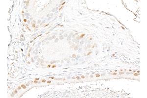 Immunohistochemistry (IHC) image for anti-Androgen Receptor (AR) (AA 1-50) antibody (ABIN7795785)