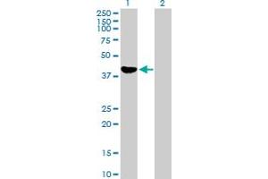 Western Blot analysis of ADH1C expression in transfected 293T cell line by ADH1C MaxPab polyclonal antibody. (ADH1C 抗体  (AA 1-375))