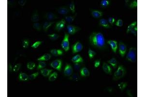 Immunofluorescence staining of Hela cells with ABIN7173546 at 1:66, counter-stained with DAPI. (TRO 抗体  (AA 1-164))
