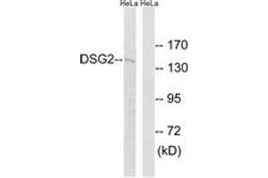 Western blot analysis of extracts from HeLa cells, using DSG2 Antibody. (Desmoglein 2 抗体  (AA 401-450))