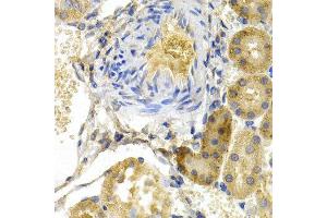 Immunohistochemistry (IHC) image for anti-BCL2-Associated Agonist of Cell Death (BAD) (C-Term) antibody (ABIN6218665) (BAD 抗体  (C-Term))