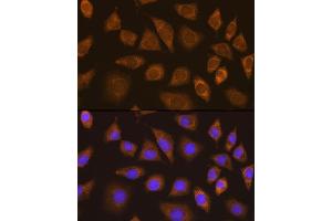 Immunofluorescence analysis of L929 cells using TRIM25 Rabbit pAb  at dilution of 1:100. (TRIM25 抗体  (AA 100-400))