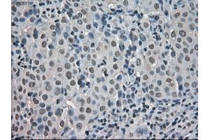 Immunohistochemical staining of paraffin-embedded pancreas tissue using anti-CRYABmouse monoclonal antibody. (CRYAB 抗体)
