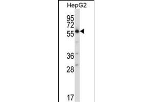 Western Blotting (WB) image for anti-Solute Carrier Family 30 (Zinc Transporter), Member 1 (SLC30A1) (AA 458-487), (C-Term) antibody (ABIN657893)