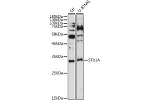 Western blot analysis of extracts of various cell lines, using STX1A antibody (ABIN7270684) at 1:1000 dilution. (STX1A 抗体)