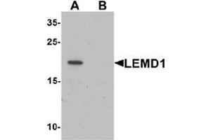 Western blot analysis of LEMD1 in A20 cell lysate with LEMD1 Antibody  at 1 ug/mL in (A) the absence and (B) the presence of blocking peptide. (LEMD1 抗体  (Middle Region))