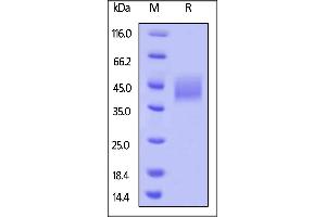 SDS-PAGE (SDS) image for CD276 (CD276) (AA 29-245) protein (His tag,AVI tag,Biotin) (ABIN5674582)