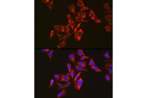 Immunofluorescence analysis of U2OS cells using Sterol carrier protein 2 antibody (ABIN7270597) at dilution of 1:50. (SCP2 抗体)