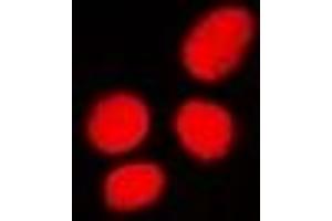 Immunofluorescent analysis of PHC3 staining in U2OS cells. (PHC3 抗体)