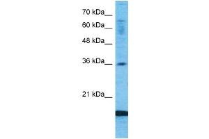 Host:  Rabbit  Target Name:  CCL18  Sample Type:  Fetal Lung lysates  Antibody Dilution:  1. (CCL18 抗体  (Middle Region))