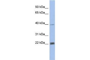 WB Suggested Anti-PSMA4 Antibody Titration: 0. (PSMA4 抗体  (N-Term))