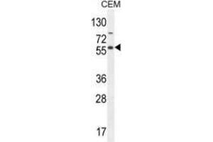 Western blot analysis in CEM cell line lysates (35ug/lane) using NFKBIL1  Antibody . (NFKBIL1 抗体  (Middle Region))