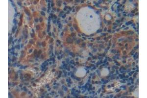 Used in DAB staining on fromalin fixed paraffin- embedded rectum tissue (PLXNB1 抗体  (AA 200-727))