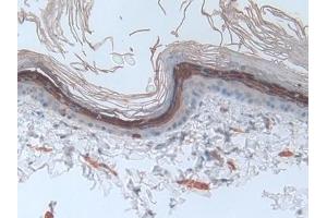 Detection of INV in Rat Skin Tissue using Polyclonal Antibody to Involucrin (INV) (Involucrin 抗体  (AA 461-551))