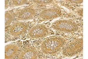 IGF2BP3 Mouse Monoclonal Antibody at 1/100 staining human normal colon tissue by IHC-P. (IGF2BP3 抗体)