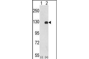 Western blot analysis of PTK2 (arrow) using rabbit polyclonal PTK2 Antibody (C-term) (ABIN652554 and ABIN2842372).