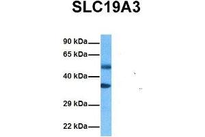 Host:  Rabbit  Target Name:  SLC19A3  Sample Tissue:  Human Ovary Tumor  Antibody Dilution:  1. (SLC19A3 抗体  (Middle Region))