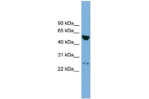 WB Suggested Anti-DEPDC7 Antibody Titration:  0. (DEPDC7 抗体  (N-Term))