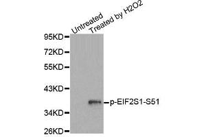 Western blot analysis of extracts from Jurkat cells, using Phospho-EIF2S1-S51 antibody (ABIN2987989). (EIF2S1 抗体  (pSer51))
