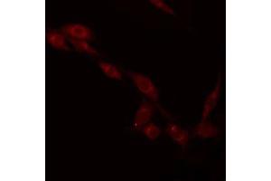 ABIN6275275 staining Hela by IF/ICC. (NDUFV2 抗体  (N-Term))