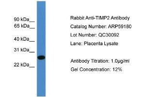 WB Suggested Anti-TIMP2  Antibody Titration: 0. (TIMP2 抗体  (N-Term))