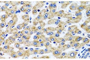 Immunohistochemistry of paraffin-embedded Human liver using SERPINA7 Polyclonal Antibody at dilution of 1:100 (40x lens). (SERPINA7 抗体)