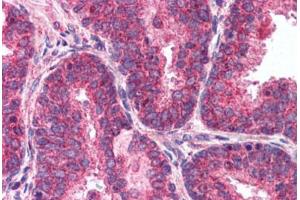 Human Prostate (formalin-fixed, paraffin-embedded) stained with mTOR antibody ABIN214561 at 2. (MTOR 抗体  (AA 2440-2457))