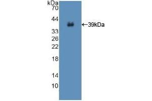 Detection of Recombinant ISR, Human using Polyclonal Antibody to Insulin Receptor (INSR) (Insulin Receptor 抗体  (AA 1027-1364))