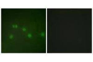 Immunofluorescence analysis of HUVEC cells, using COT2 antibody. (NR2F2 抗体  (N-Term))