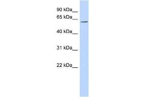 Western Blotting (WB) image for anti-Transmembrane Protein 209 (TMEM209) antibody (ABIN2460092) (TMEM209 抗体)