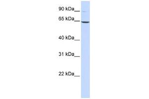 WB Suggested Anti-LTA4H Antibody Titration: 0.